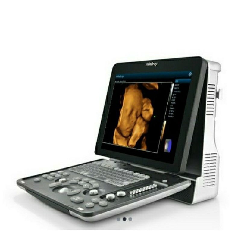 USG 2D (Mindray) 2 color with convex and Linear Probe